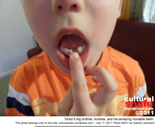 Big brother Andrew and his teeth